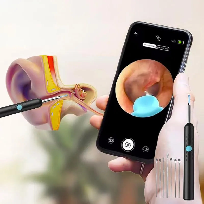 NovaClean™ – Caméra Intelligente de Nettoyage des Oreilles