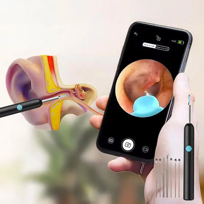 NovaClean™ – Caméra Intelligente de Nettoyage des Oreilles