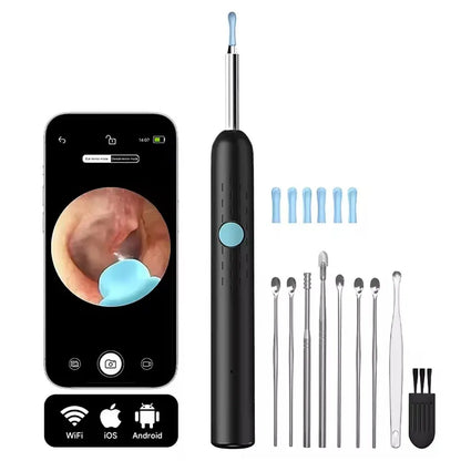 NovaClean™ – Caméra Intelligente de Nettoyage des Oreilles
